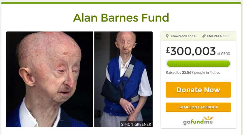 Alan Barnes Fund raises £300k in four days on GoFundMe.com